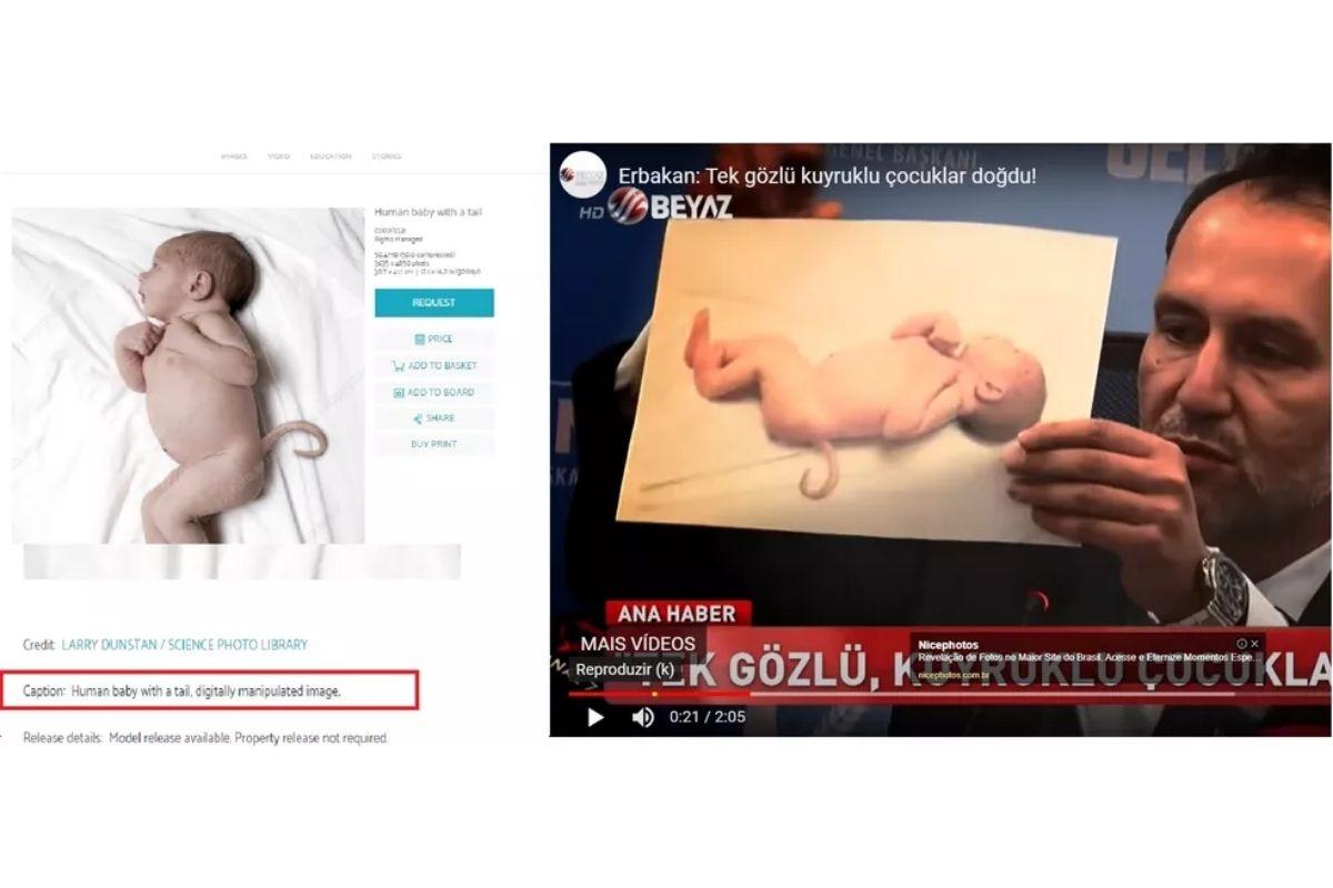 Imagem de bebês com rabo, pelos e membros a mais não tem relação com vacina da covid-19