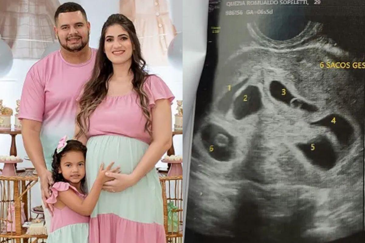 Mulher grávida de sêxtuplos