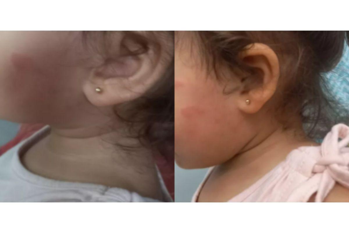 Professora gera revolta após agredir criança de 1 ano em sala de aula