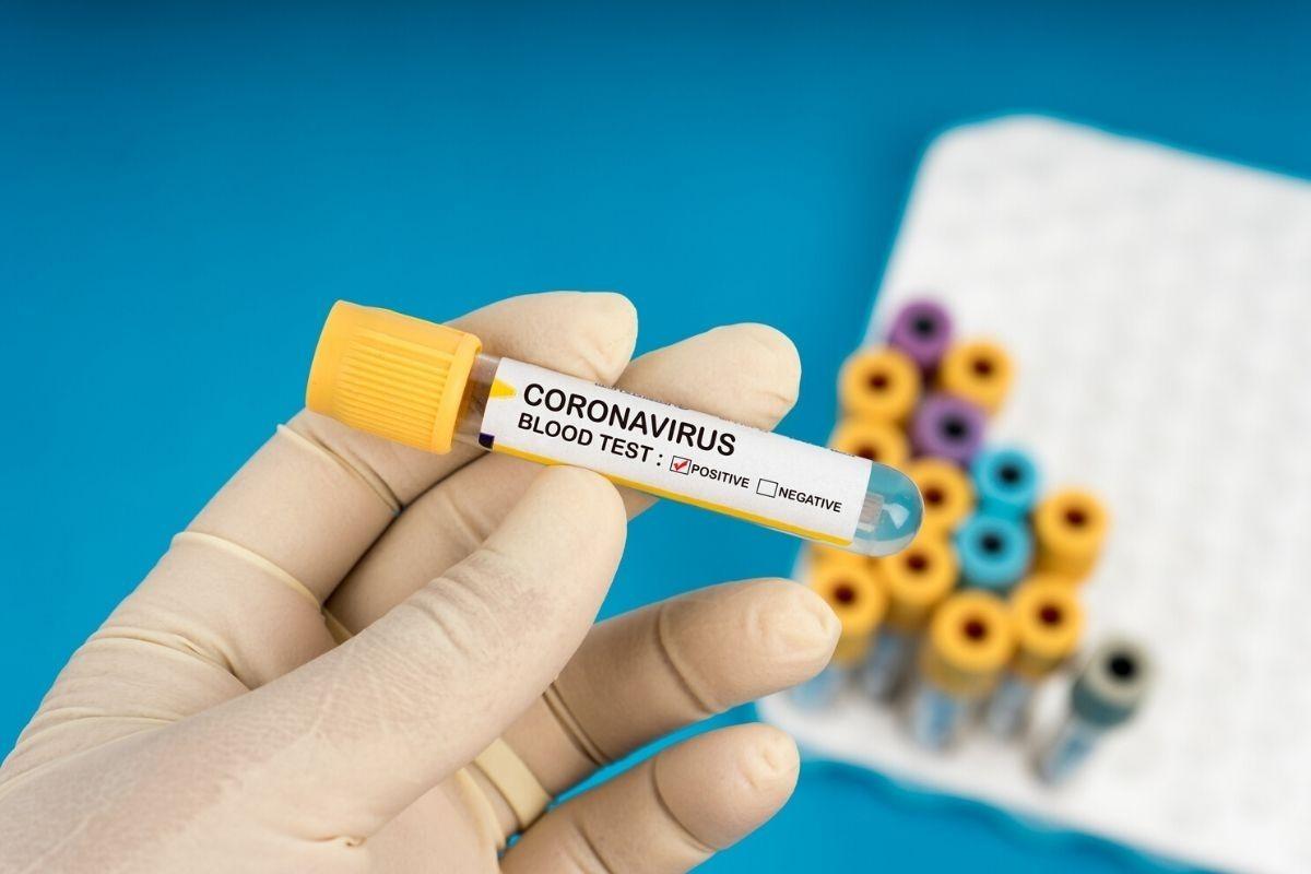 O pai transmitiu covid-19 para a filha de propósito