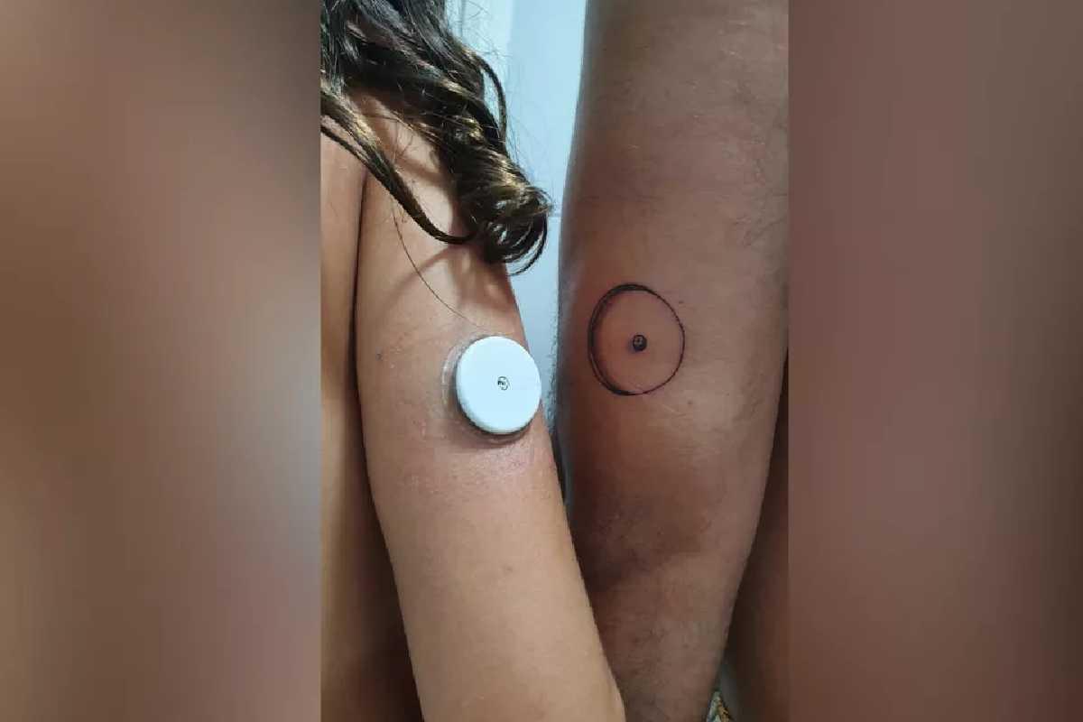 Pai decide tatuar sensor de glicose para surpreender filha em tratamento para diabetes