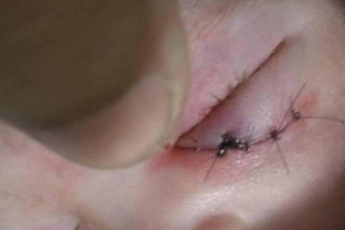 Olho do bebê com os pontos