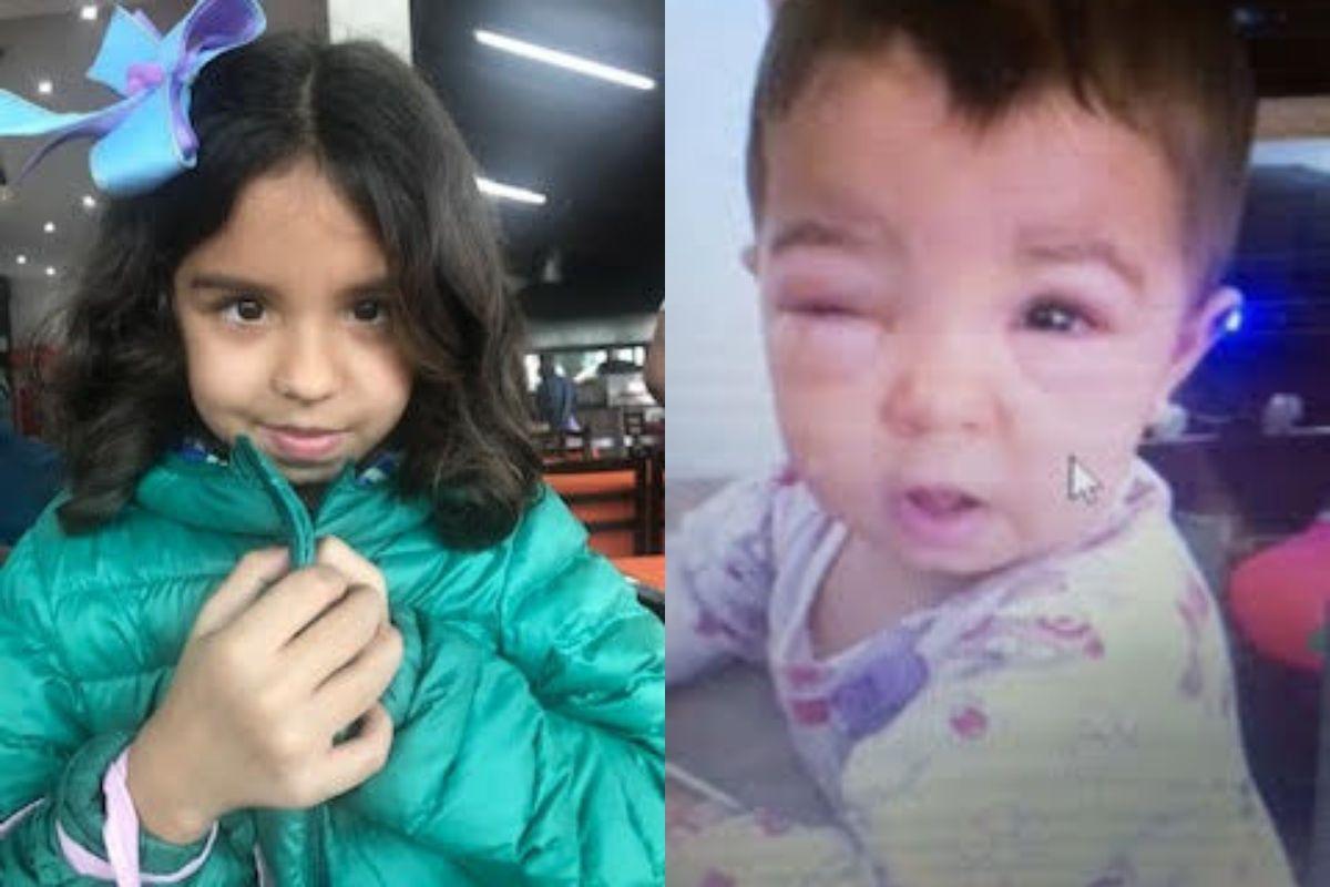 Alice foi diagnosticada com retinoblastoma