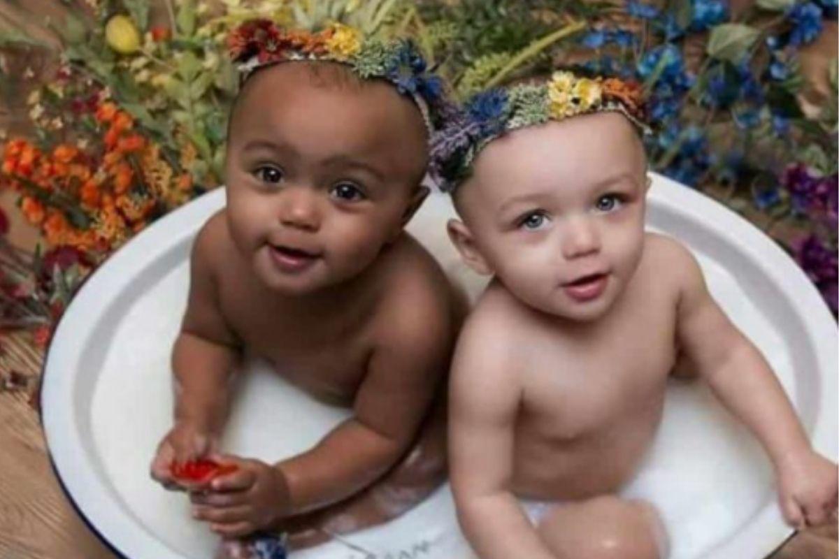 Gêmeas nascem com cores de pele diferentes em caso raro