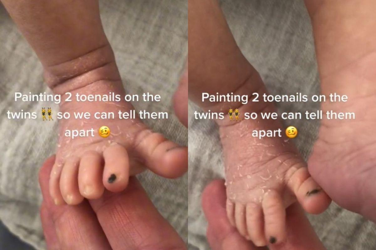A mãe disse que pinta as unhas dos bebês para diferenciá-los