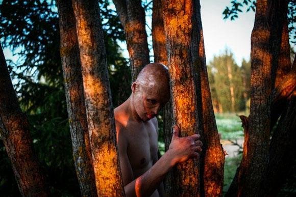 Lyosha, o menino que foi jogado no fogo (Foto: reprodução PAVEL VOLKOV)