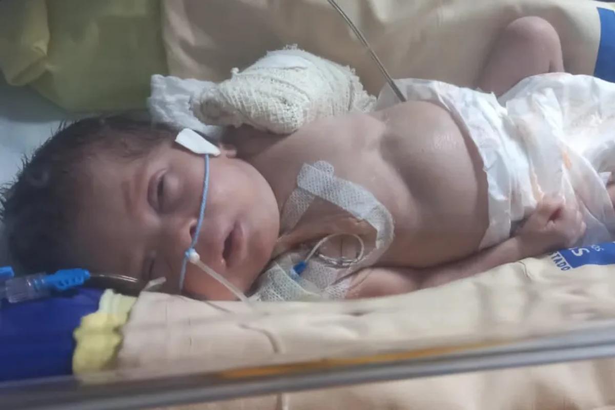 Bebê com o braço quebrado