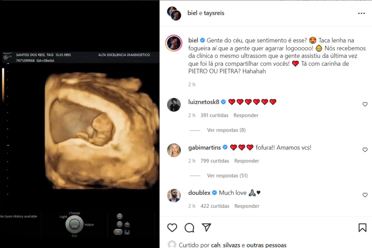 O casal mostrou o ultrassom do primeiro filho