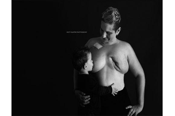 A foto mobilizou muitas mãe pelo mundo (Foto: Reprodução/ Instagram @mjfightscancer)