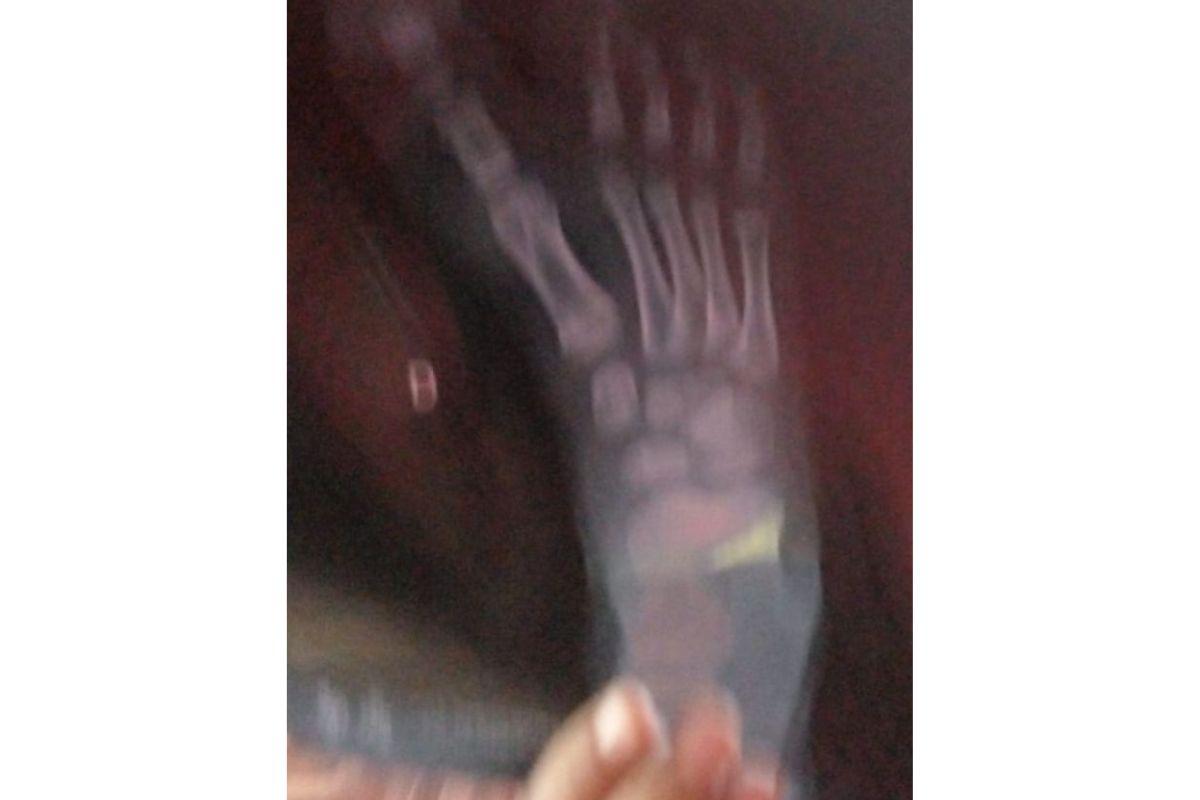 Pais tentam arrecadas dinheiro para fazer viagem em busca de um diagnóstico para o que a filha tem (Foto: Reprodução/Mídia Max)