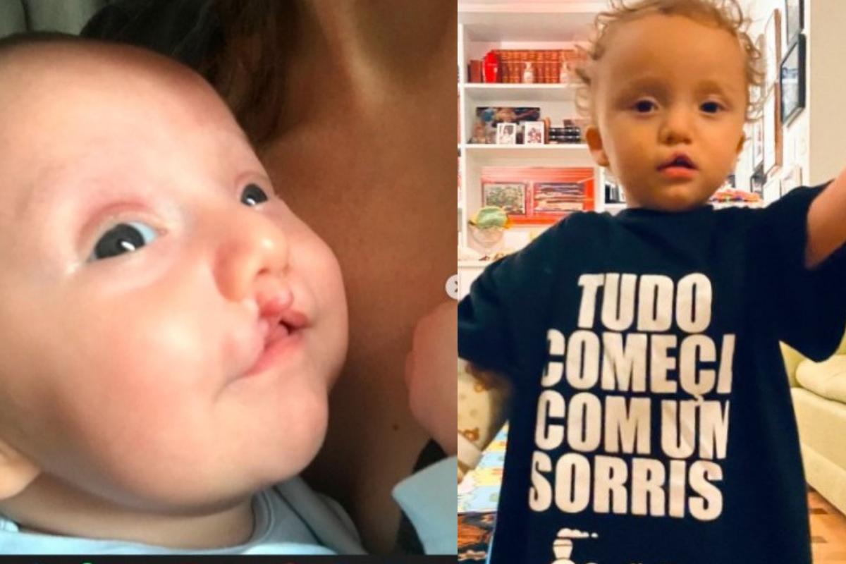 Isabel Hickmann mostrou o antes e o depois do filho