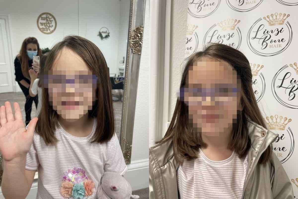 Graças ao tratamento capilar a menina conseguirá ter o cabelo de volta