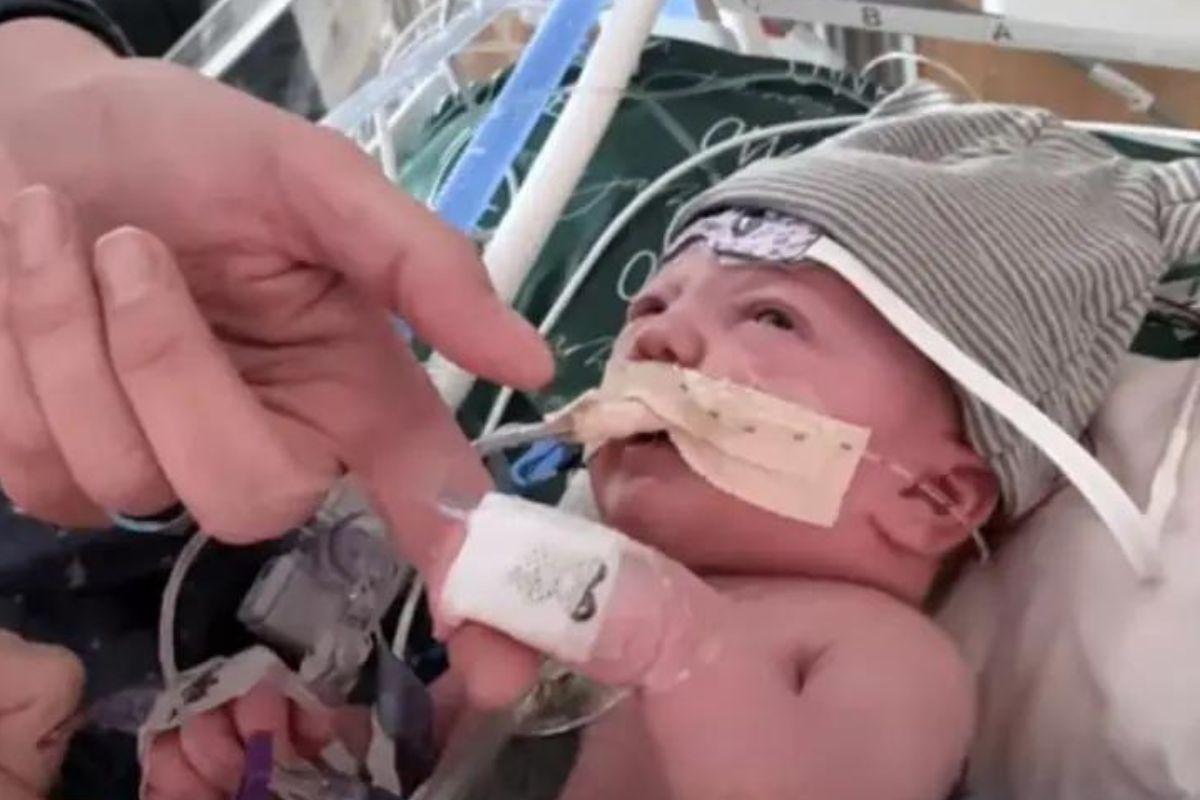 Bebê passa por transplante pioneiro de coração