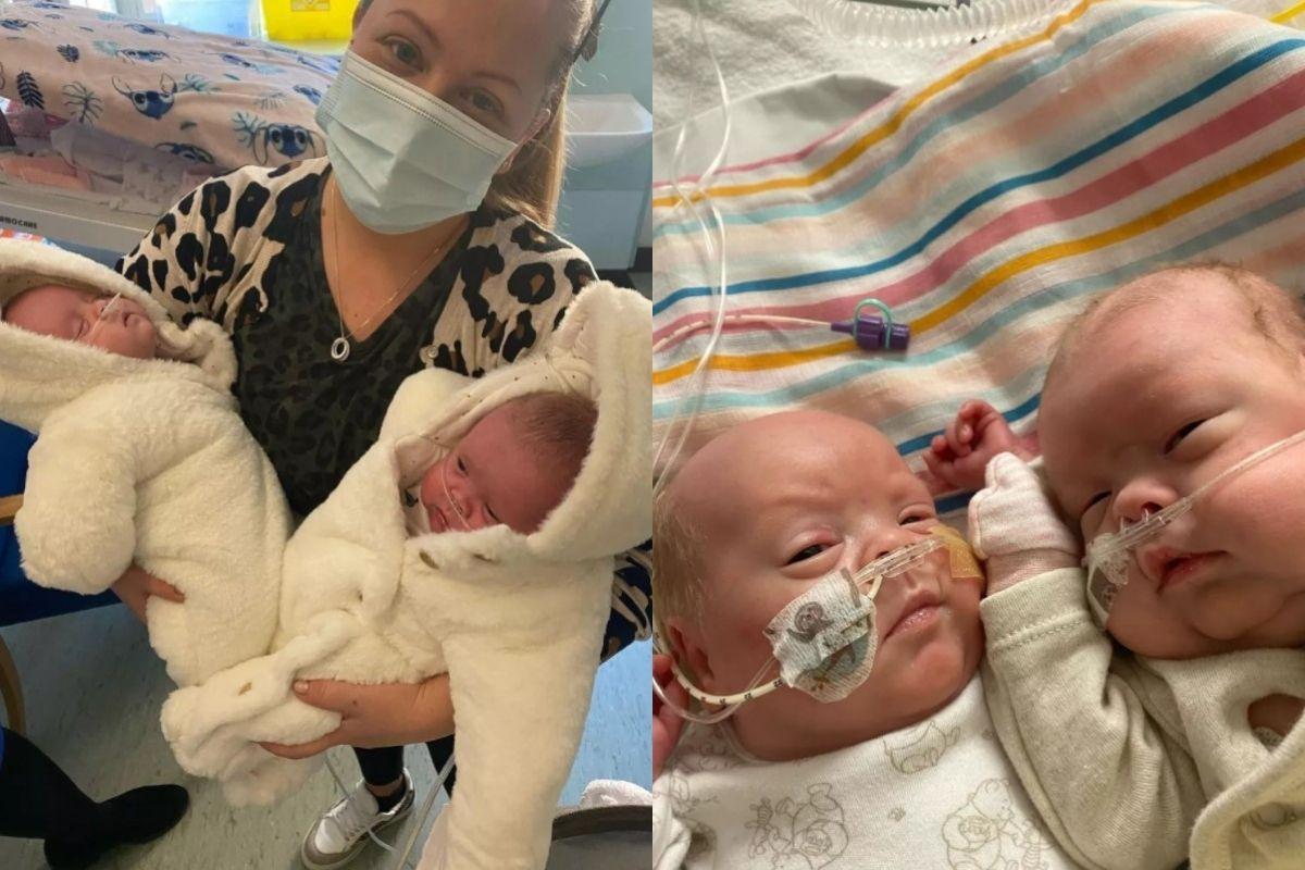 Os gêmeos prematuros nasceram com 5 meses de gestação e precisaram passar por 6 cirurgias e 25 transfusões de sangue