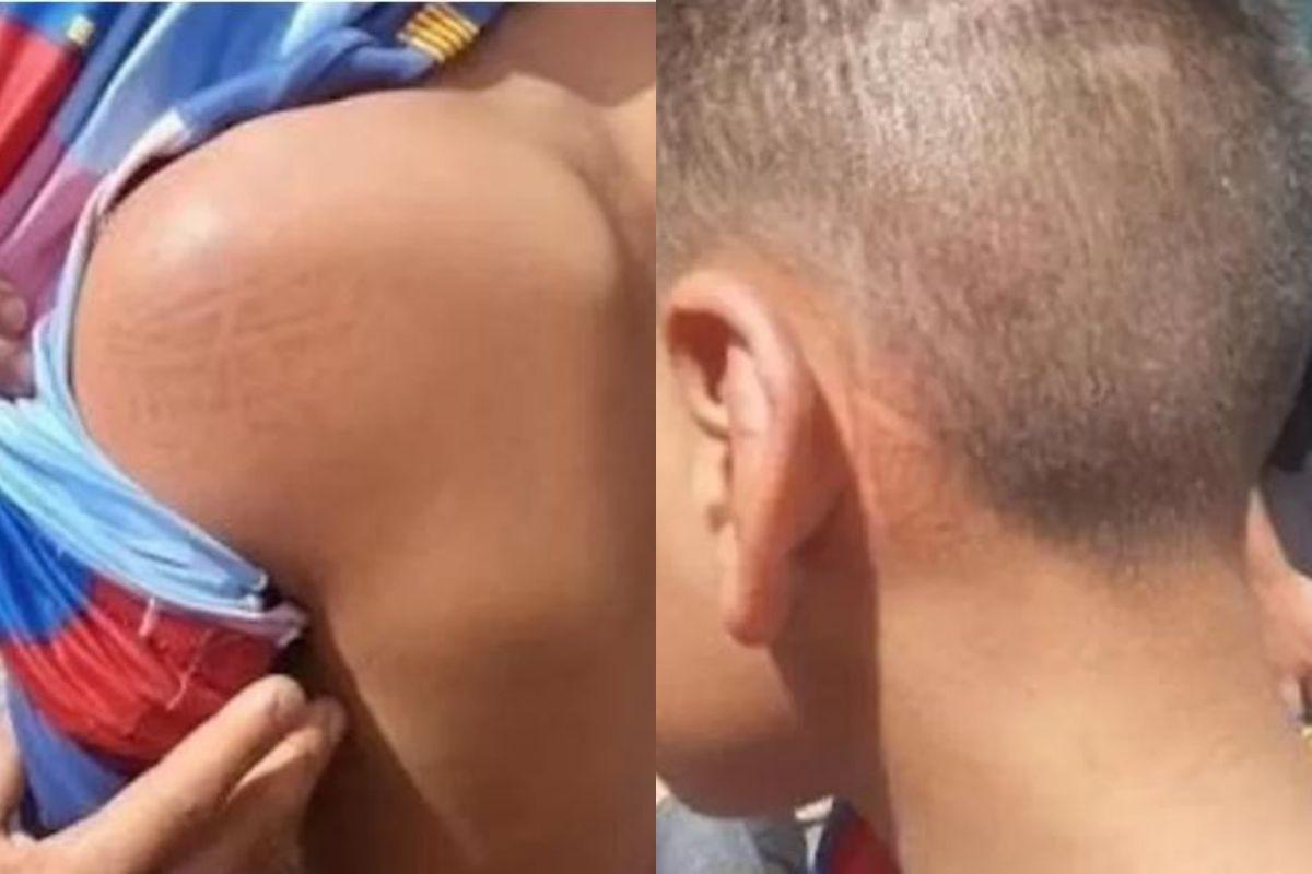 O adolescente foi agredido pelo vizinho após assobiar