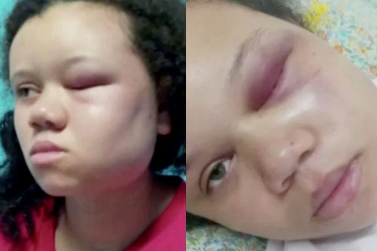 Ivone segurava o filho no colo enquanto o marido foi agredir ela