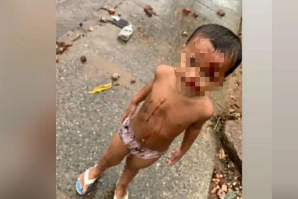 Criança é encontrada ferida e sozinha em meio a rodovia, sem lembrar o próprio nome