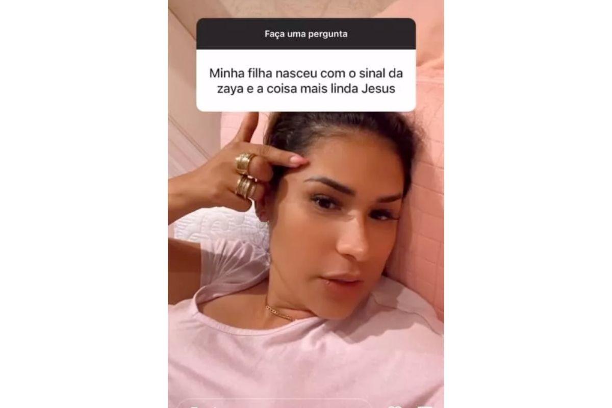 A cantora falou sobre a "mancha" nos stories