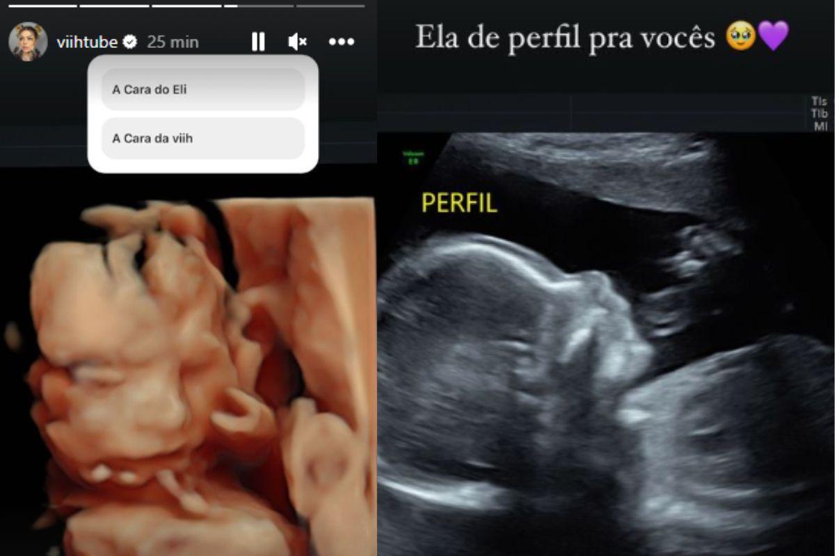 Viih Tube mostra ultrassom da filha