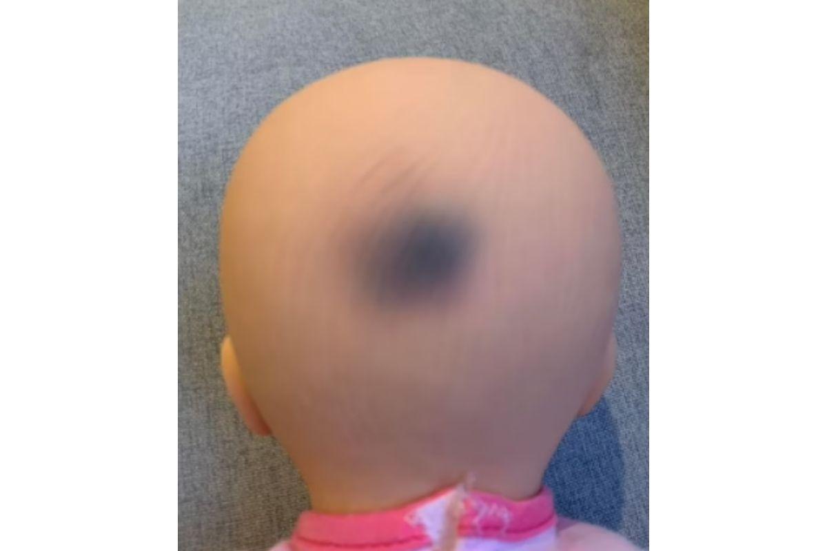 Mãe fica intrigada com marca bizarra que veio com o brinquedo que comprou para a filha: "Está aumentando"
