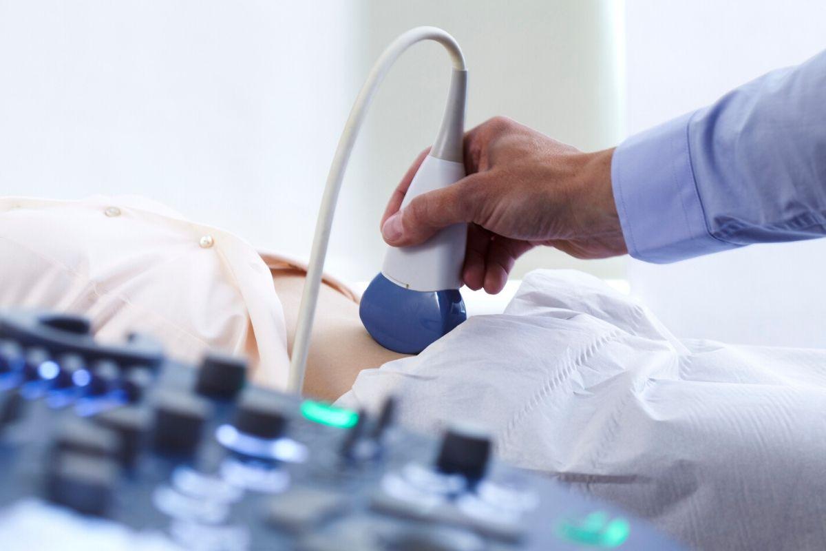 Médico confunde cocô de grávida com segundo bebê em ultrassom