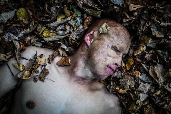 Lyosha, o menino que foi jogado no fogo (Foto: reprodução PAVEL VOLKOV)