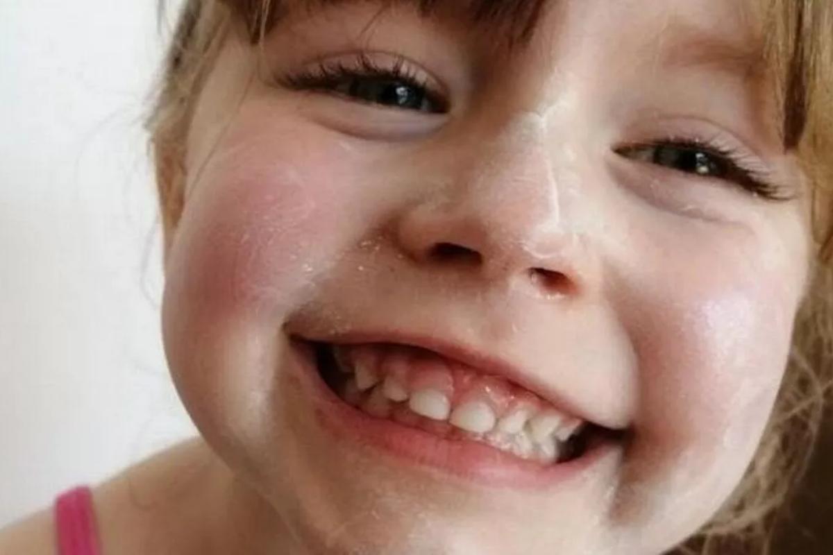 Em plena pandemia, Addy foi diagnosticada com a condição rara