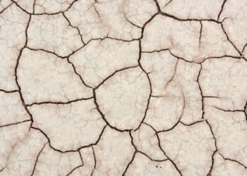 Estrias na gravidez: conheça métodos de cuidar e como evitar