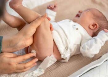 Assaduras infeccionadas: causas, sintomas e prevenções