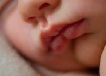 Calos de amamentação: como a pega correta faz diferença