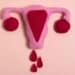 Grávidas menstruam? Entenda os sangramentos na gravidez