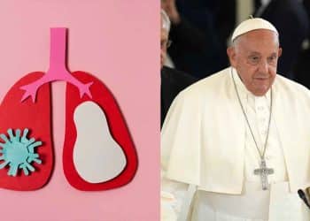 Pneumonia bilateral: o que é, sintomas e como prevenir a condição do Papa Francisco