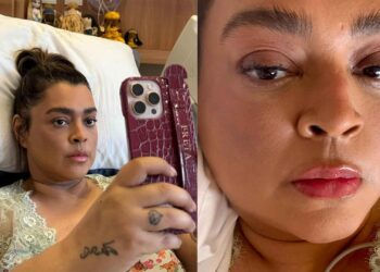 Bolsa de colostomia permanente: entenda a condição da Preta Gil