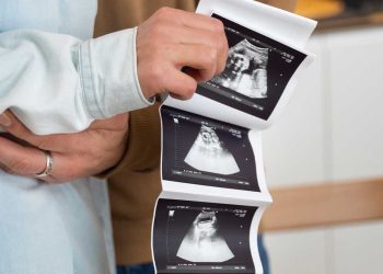 Gravidez: ultrassonografia no primeiro trimestre reduz 81% das emergências