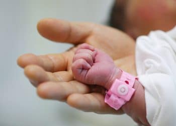 Por que os bebês nascem com a pele arroxeada?