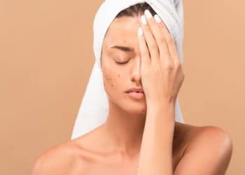 Diga Adeus às Espinhas! Rotina de Cuidados Para Uma Pele Perfeita