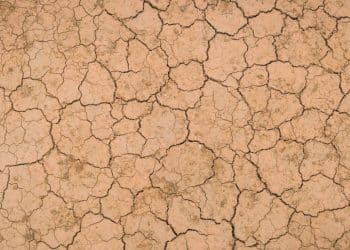 Estrias na gravidez: como lidar com elas e entender suas causas