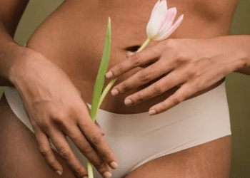 Como tratar estrias? Veja as opções que funcionam de verdade!