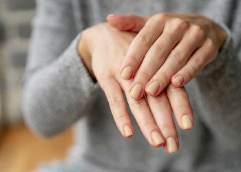 Por que as unhas ficam amarelas? Veja as principais causas e soluções