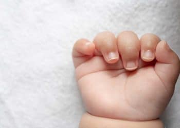 Unha encravada em bebê: dicas para prevenir e aliviar o desconforto