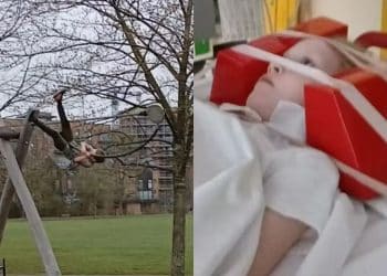 Criança fratura o pescoço ao ser arremessada por brinquedo com histórico de acidentes