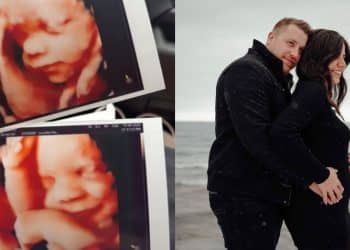 Alerta fofura: bebê sorri ao ouvir a voz do pai durante exame de ultrassom