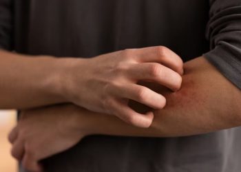 Síndrome de Alagille, doença que causa coceira extrema, ganha nova opção de tratamento