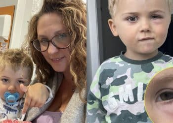 Mãe descobre doença grave do filho após questionar diagnóstico inicial: “Disseram que era rinite alérgica”