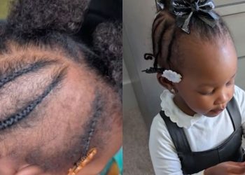 Mãe denuncia creche após filha de 2 anos voltar para casa com pedaço de cabelo arrancado