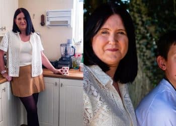 Ela achou que estava tendo um AVC após o parto — mas era algo ainda mais raro