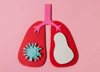 Tosse: como saber se é viral, bacteriana ou apenas uma irritação