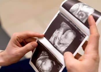 Depois de três abortos, ela viveu algo raro: engravidou duas vezes no mesmo mês