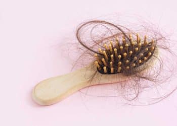 Queda de cabelo em crianças: saiba o que é alopecia infantil e como lidar