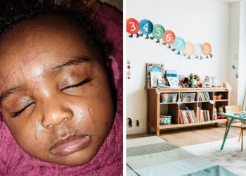 Bebê de 10 meses volta da creche com olho roxo e arranhões; mãe exige justiça